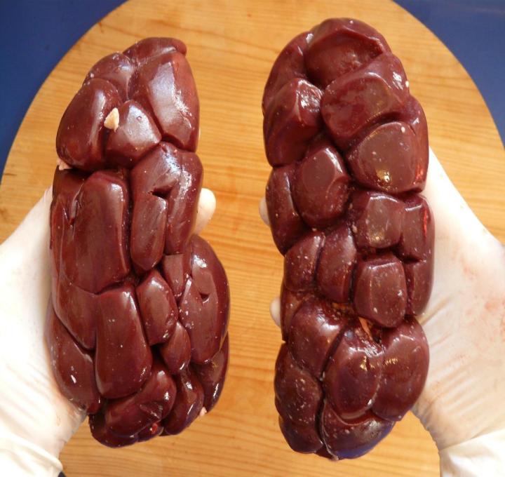 beef-kidney-ge771a758c_1920_0.jpg